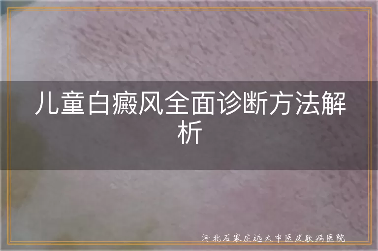 儿童白癜风诊断方法解析, 白癜风全面诊断步骤, 白斑鉴别诊断与护理