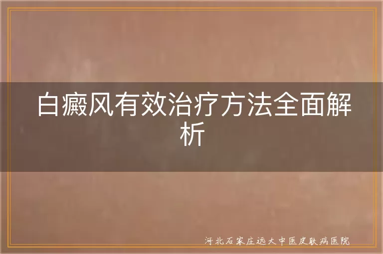 白癜风有效治疗解析,白斑治疗方法,白癜风综合治疗