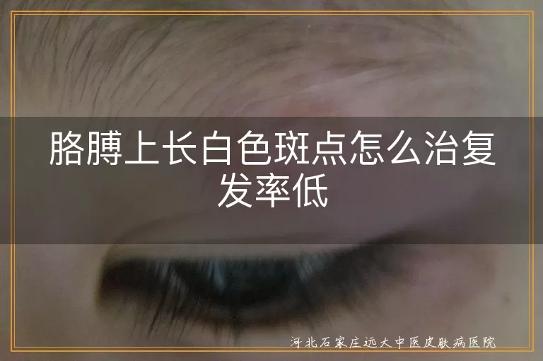 胳膊白癜风如何治疗不复发,白斑病治疗方法降低复发率,白癜风治疗后如何防复发