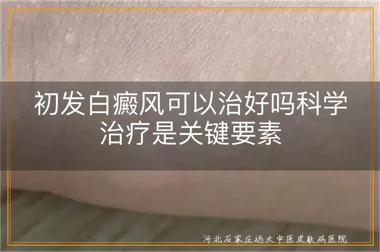 初发白癜风能否治愈,科学治疗白癜风方法,白癜风生活调理建议