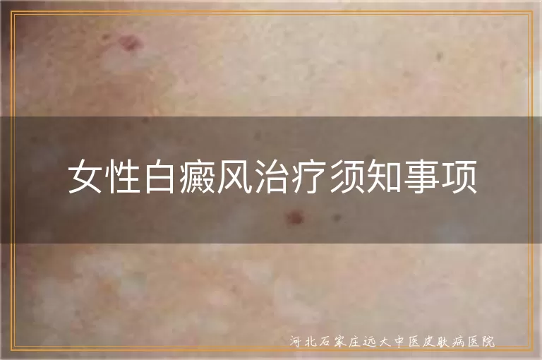 女性白癜风治疗方法,白癜风患者生活注意事项,白斑心理支持重要性