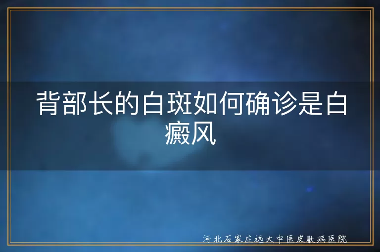 背部白斑确诊白癜风方法, 白斑类型与白癜风鉴别, 白癜风诊断与治疗指南