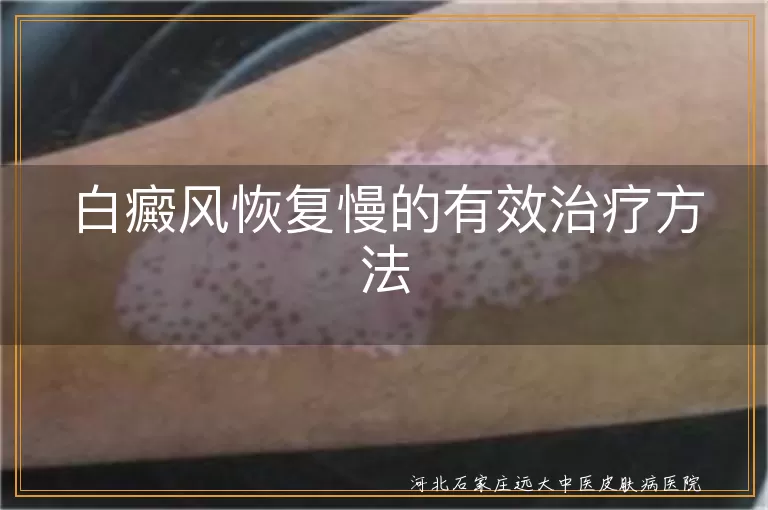 白癜风恢复慢治疗方法,白癜风有效治疗手段,白斑恢复慢如何解决