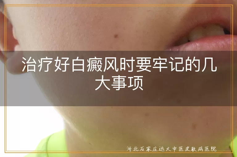 白癜风饮食禁忌,白斑预防复发方法,白癜风患者心态调整