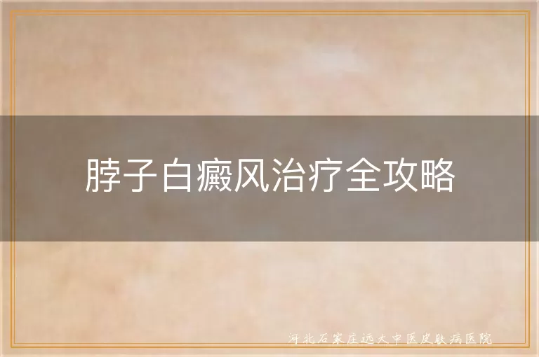 脖子白癜风治疗全攻略