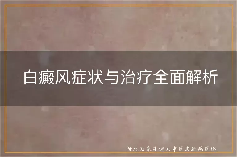白癜风症状详解,白癜风多种治疗方法,白斑患者生活指南
