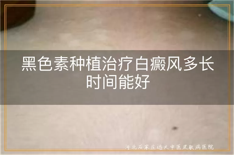 白癜风黑色素种植治疗时间, 白斑黑色素种植恢复周期, 黑色素种植治疗白斑效果