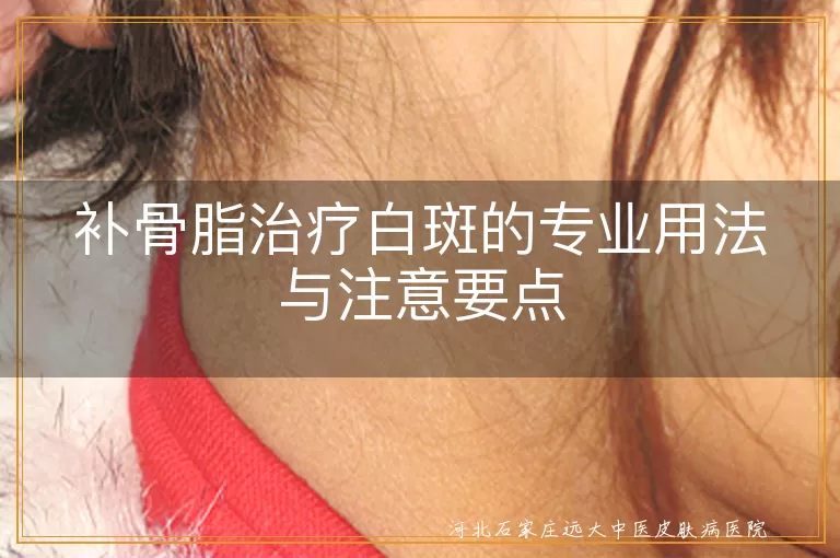补骨脂治疗白斑的专业用法与注意要点