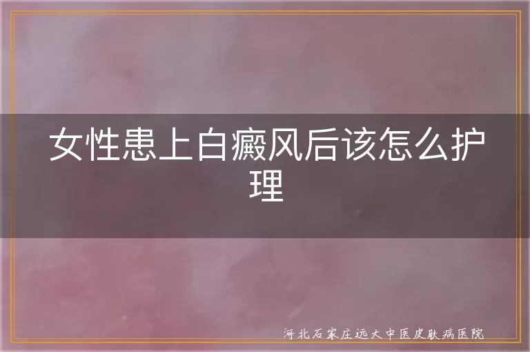 女性白癜风日常护理,白癜风科学治疗方法,白癜风患者心理支持