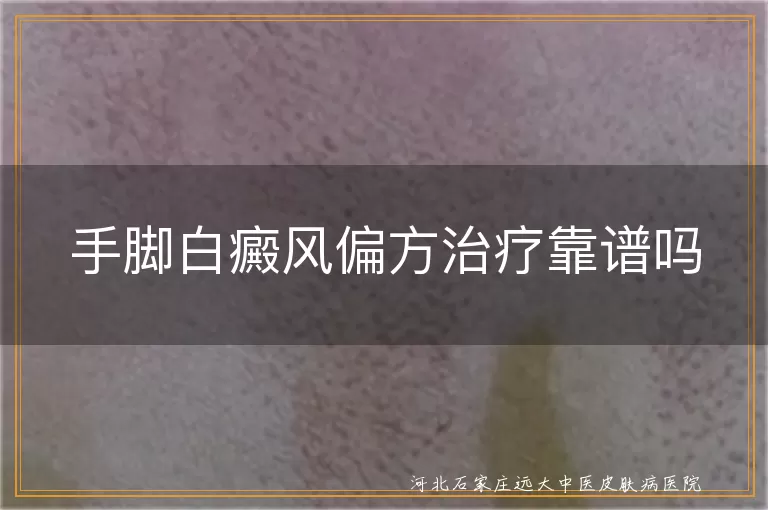 手脚白癜风偏方风险,白癜风正规治疗重要性,白斑科学治愈方法