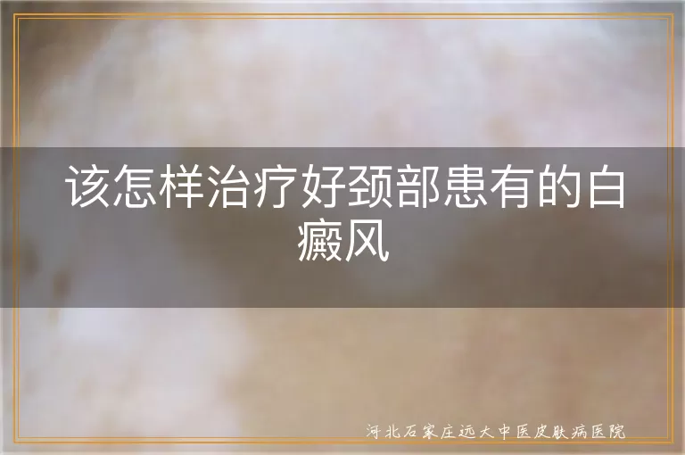 颈部白癜风综合治疗方案,颈部白斑科学治疗方法,白癜风颈部部位修复技巧