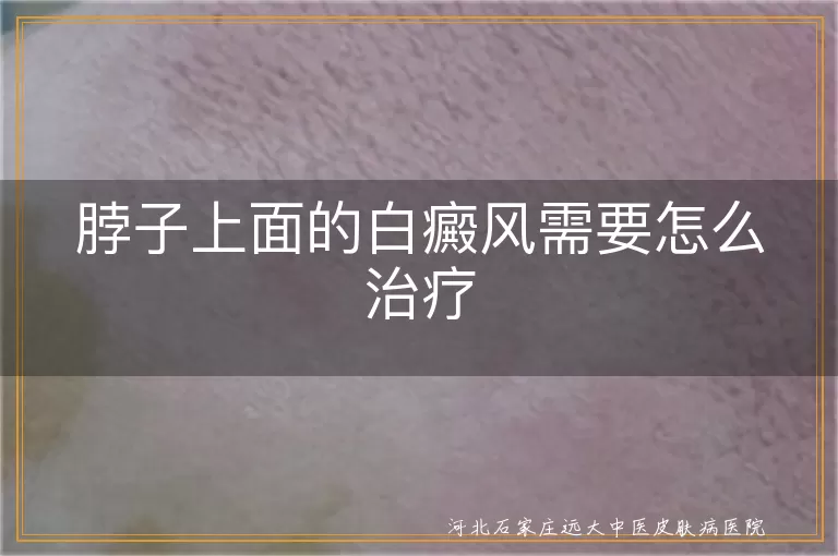 颈部白癜风综合治疗方案,脖子上白斑治疗手段,白癜风颈部病变科学干预