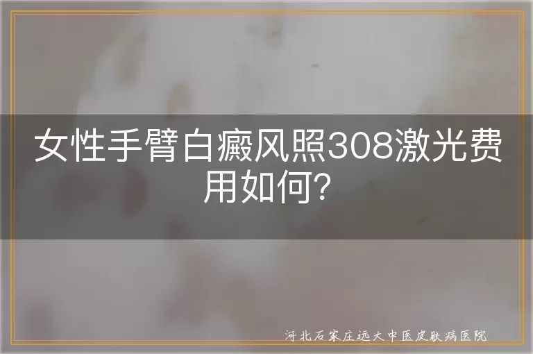 女性手臂白癜风治疗费用,308激光治疗手臂白斑价格,手臂白斑照308激光花费