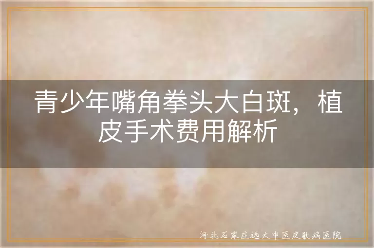 青少年嘴角白癜风治疗费用,嘴角白斑植皮手术价格,青少年白癜风植皮手术成本