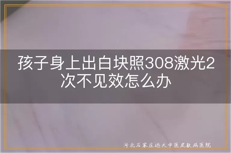 儿童白癜风308激光治疗无进展应对,儿童白斑308激光两次未改善原因,儿童白斑308治疗短期无效策略