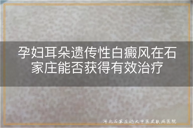 孕妇遗传性白癜风耳朵治疗,石家庄白斑病医院方案,白癜风孕期安全诊疗