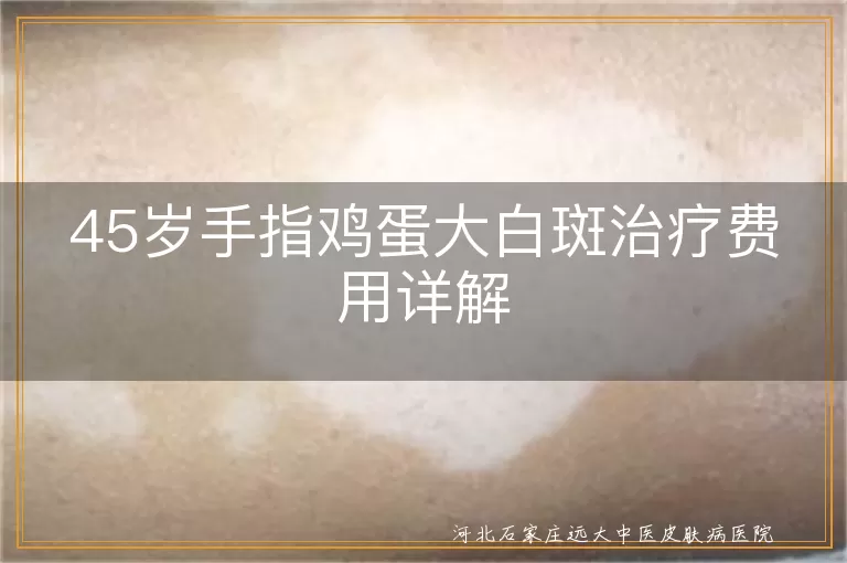 45岁手指白癜风治疗费用影响因素,鸡蛋大小白斑规范治疗费用范围,手指部位白癜风综合治疗成本