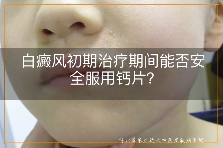 白癜风治疗期补钙注意事项,白斑初期阶段钙片选择,白癜风患者钙剂补充指南