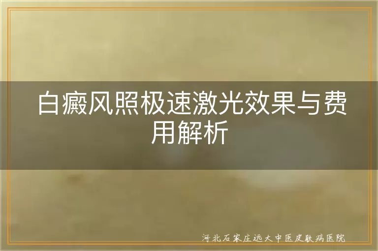 白癜风极速激光治疗效果,白癜风激光治疗费用多少,白斑疾病激光治疗适用性