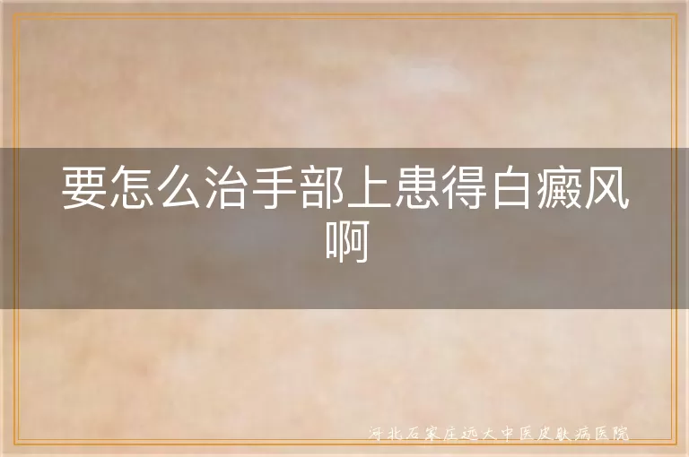 手部白癜风综合治疗措施,白斑扩散的手部护理建议,白癜风手部症状科学疗法