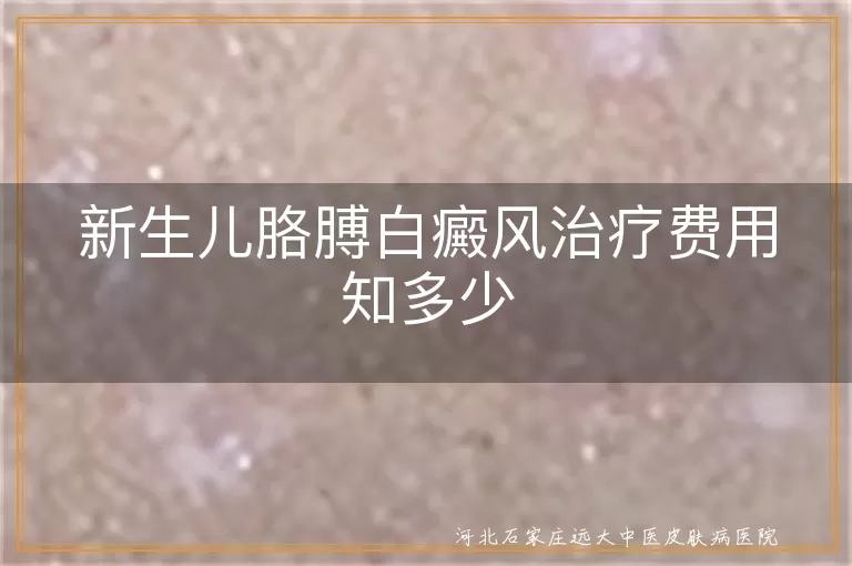 新生儿胳膊白癜风治疗费用,新生儿白斑早期干预成本,儿童白癜风规范诊疗预算