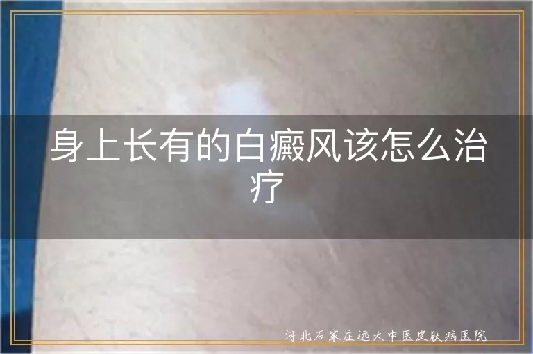 白癜风综合治疗方法有哪些,白癜风早期如何科学治疗,进展期白癜风治疗方案选择