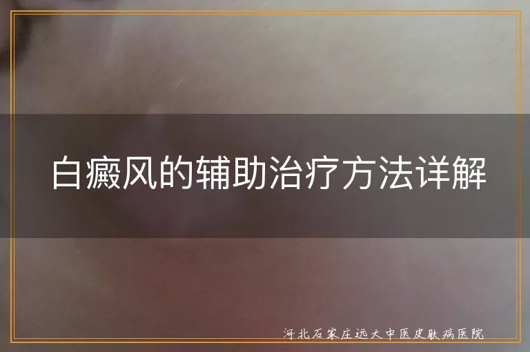 白癜风辅助治疗手段有哪些,皮肤白斑日常护理与治疗,白癜风综合治疗与心理干预