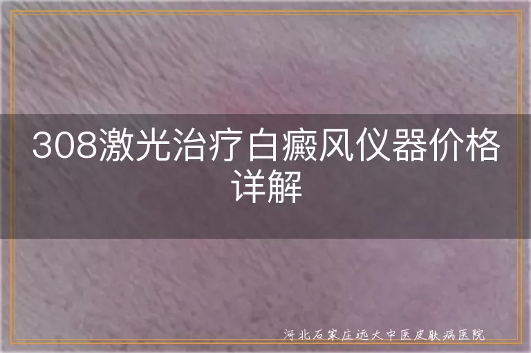 白癜风治疗308激光设备价格解析,白斑修复308光疗仪器费用详解,308准分子激光治白癜风成本分析