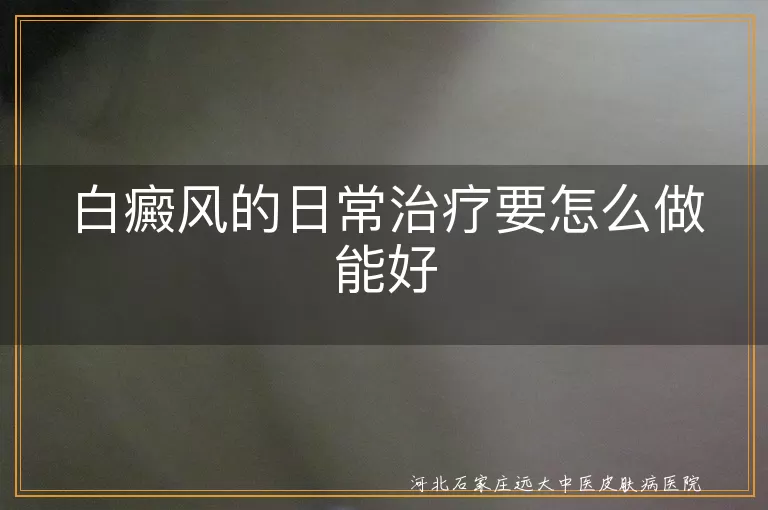 白癜风日常护理要点,白癜风患者生活管理,白癜风自我治疗注意事项
