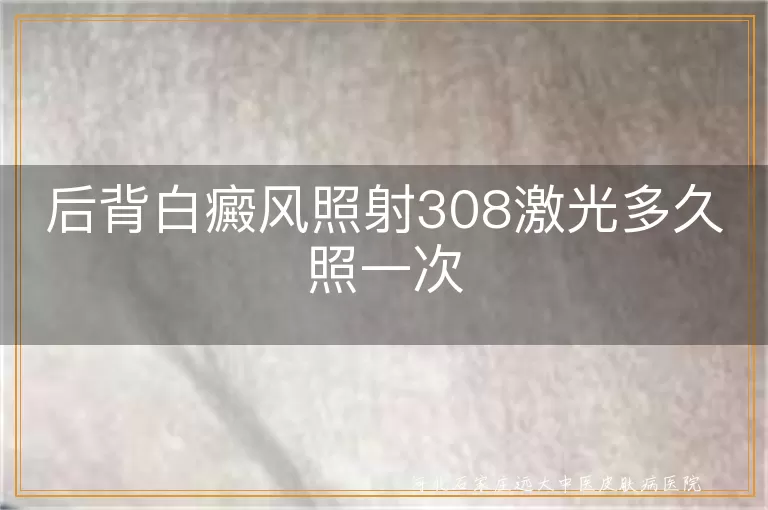 后背白癜风308激光频率,背部白斑308激光治疗间隔,白癜风308激光照射周期