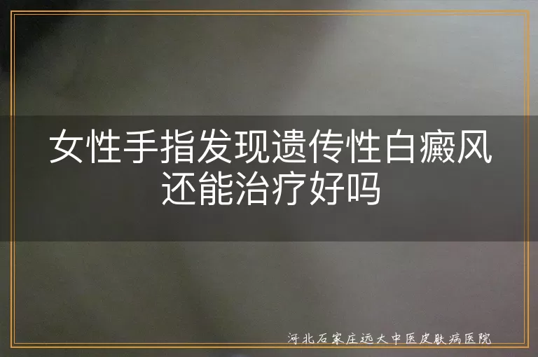 女性手指遗传性白癜风治疗方案,手指白斑遗传因素能否治愈,遗传性白癜风最新治疗进展