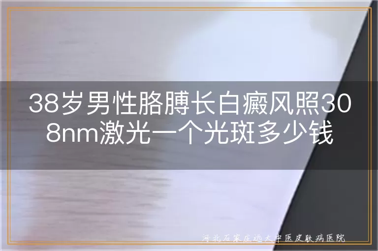 男性胳膊白癜风308激光费用,男性手臂白斑激光照价格,胳膊白癜风308照射一个光斑多少价钱
