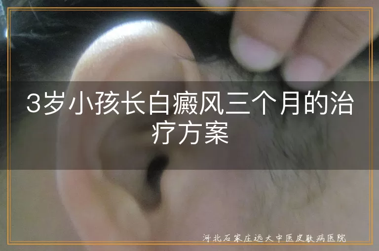3岁幼儿白斑康复记,白癜风早期干预指引,小儿白斑三个月应对策略