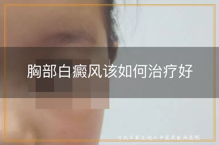 胸部白斑治疗指南,胸口白癜风恢复路径,胸前白癜风日常护理