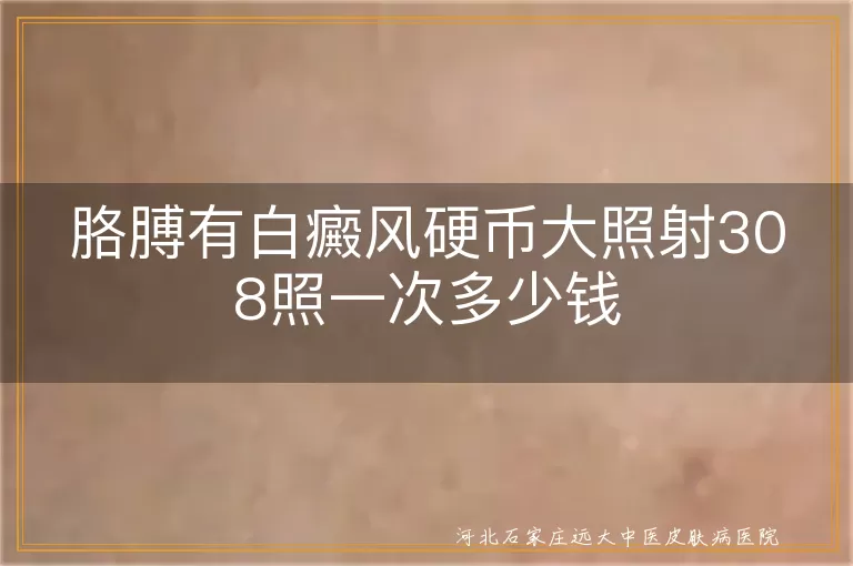 胳膊有白癜风硬币大照射308照一次多少钱