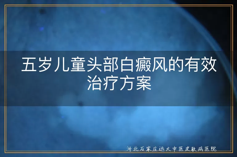 五岁儿童头部白癜风的有效治疗方案