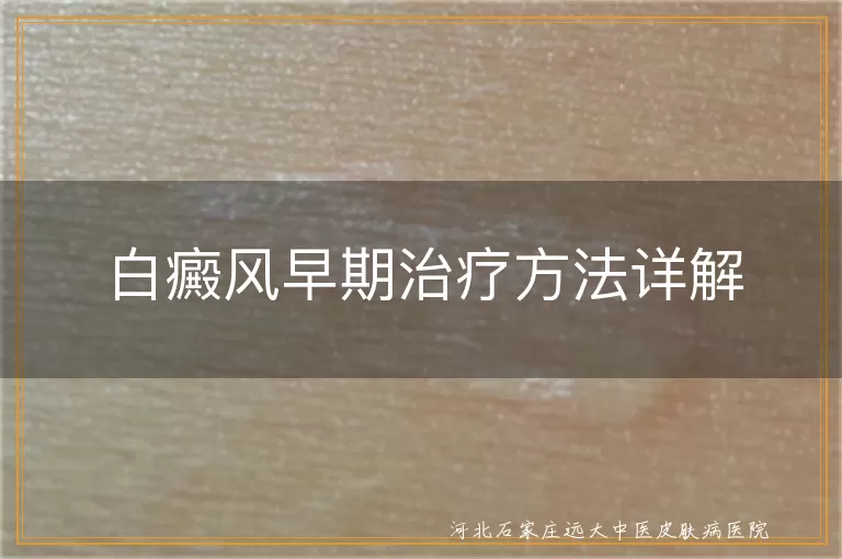 白癜风初期治疗妙招,白斑早期干预策略,白癜风早诊早治原则