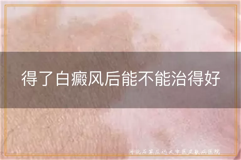 白癜风治疗痊愈可能性,白斑能否逆转真相大揭秘,白癜风长期管理可完全复色吗