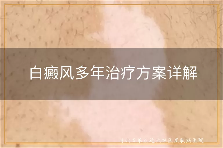 白癜风多年治疗方案详解