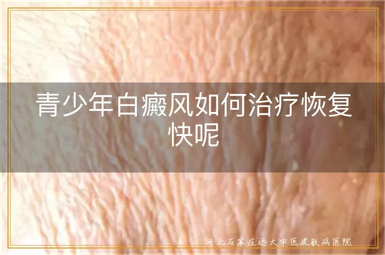 青少年白癜风快速修复方案,青少年白斑治愈时间,青少年白癜风康复关键