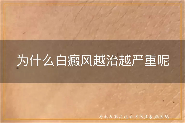 白癜风治疗误区有哪些,白斑反复发作原因,为什么白癜风越拖越重
