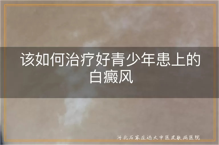青少年白癜风康复如何着手,白斑青春期干预方案,白癜风孩子心理养护要点