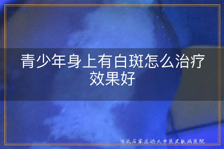 青少年白斑治疗攻略,青春期白癜风有效方案,学生白癜风康复路径