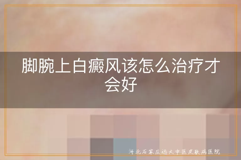 脚腕部位白斑如何巩固治疗,脚踝白癜风复发预防策略,足踝皮肤白斑护理要点