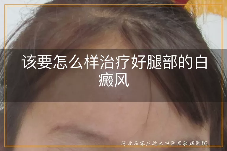 腿部白癜风康复攻略,白斑光疗加药浴,白癜风局部组合方案