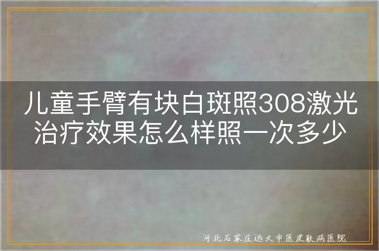 儿童白癜风308激光疗效如何,儿童白斑308一次照射时长,手臂白癜风光子治疗次数