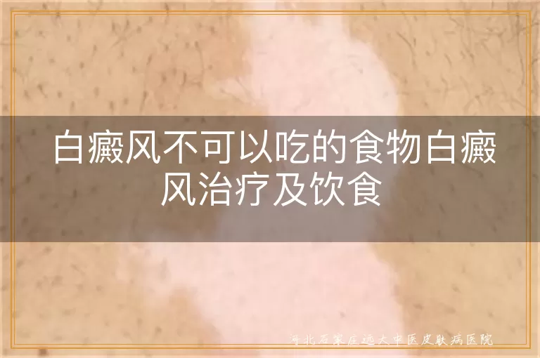 白癜风忌口餐单大公开,白斑康复饮食指南,中医调理白癜风食谱