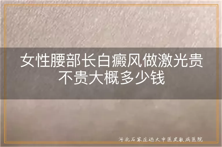 女性腰部长白癜风做激光贵不贵大概多少钱