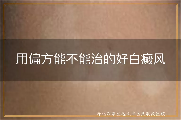用偏方能不能治的好白癜风