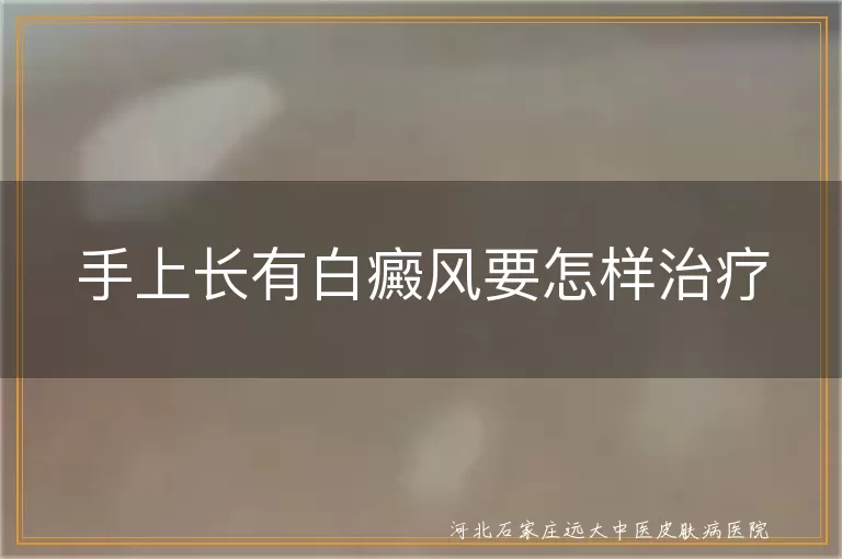手上长有白癜风要怎样治疗